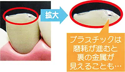 セラミックとプラスチックの違い