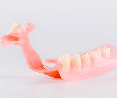 ノンクラスプデンチャー