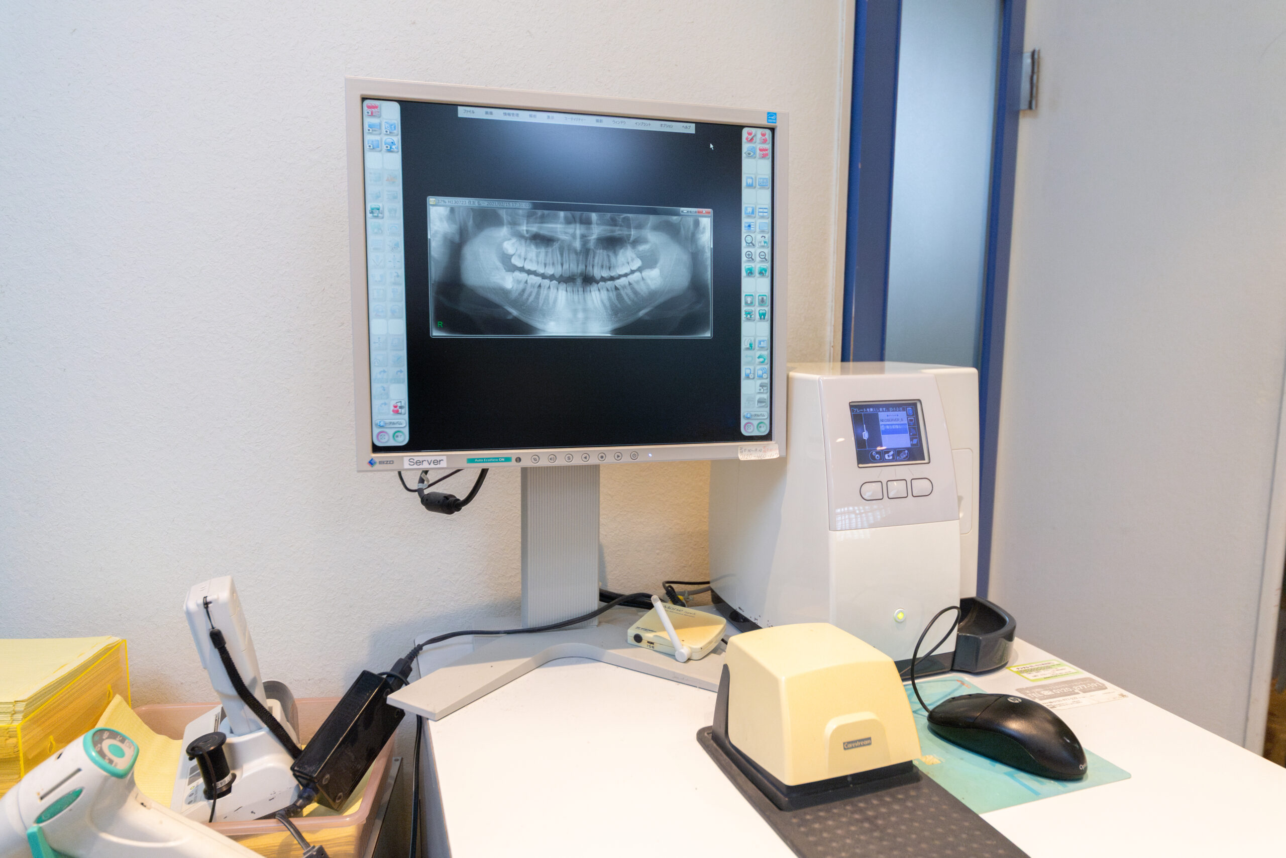 歯科用CT